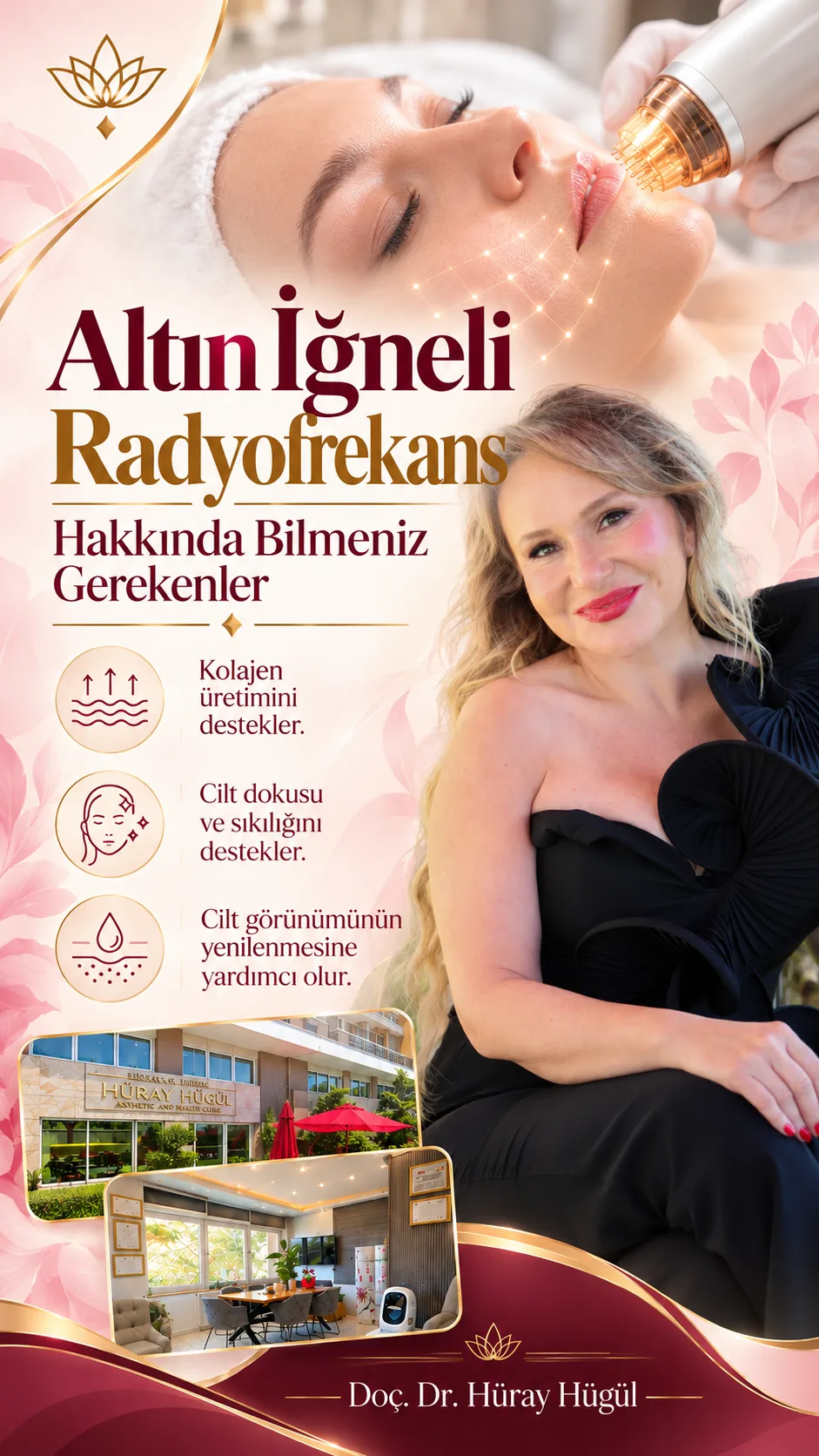 Altın İğneli Radyofrekans Hakkında Bilmeniz Gerekenler | Doç. Dr. Hüray Hügül