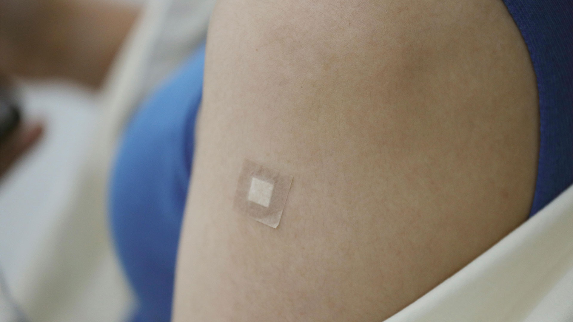 Skin Biopsy application — Assoc. Prof. Hüray Hügül
