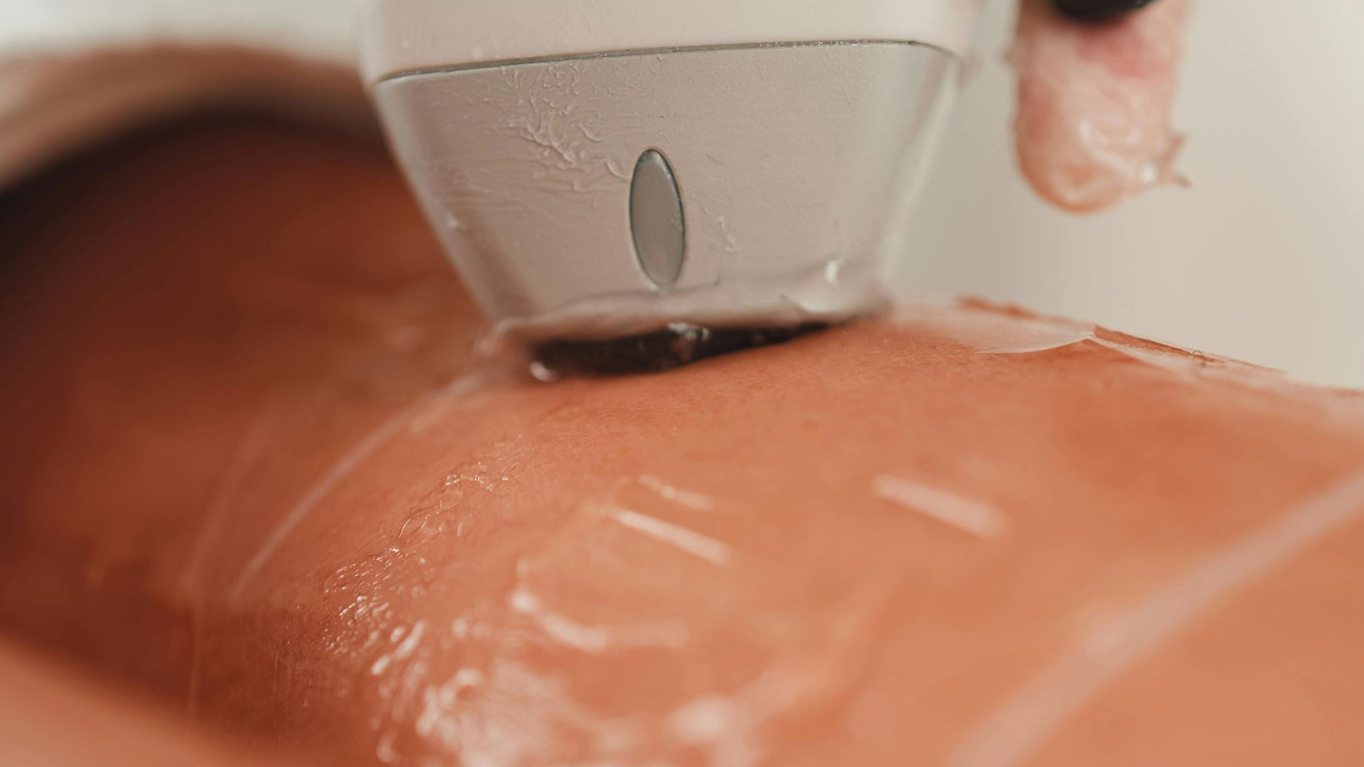Focus Ws5 Laser + Radiofrequenz Anwendung — Assoc. Prof. Hüray Hügül