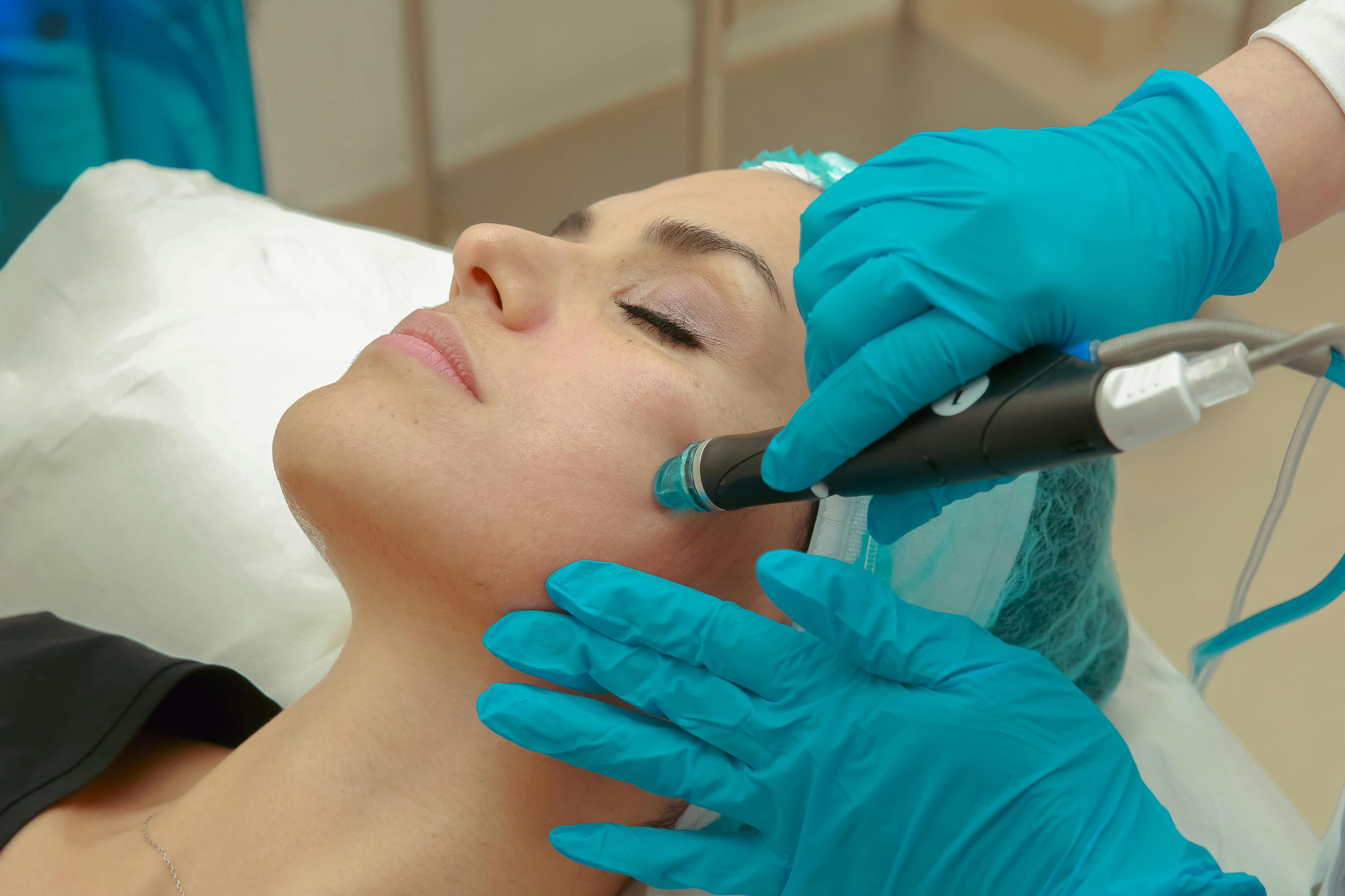 Fractional Radiofrequency application — Assoc. Prof. Hüray Hügül