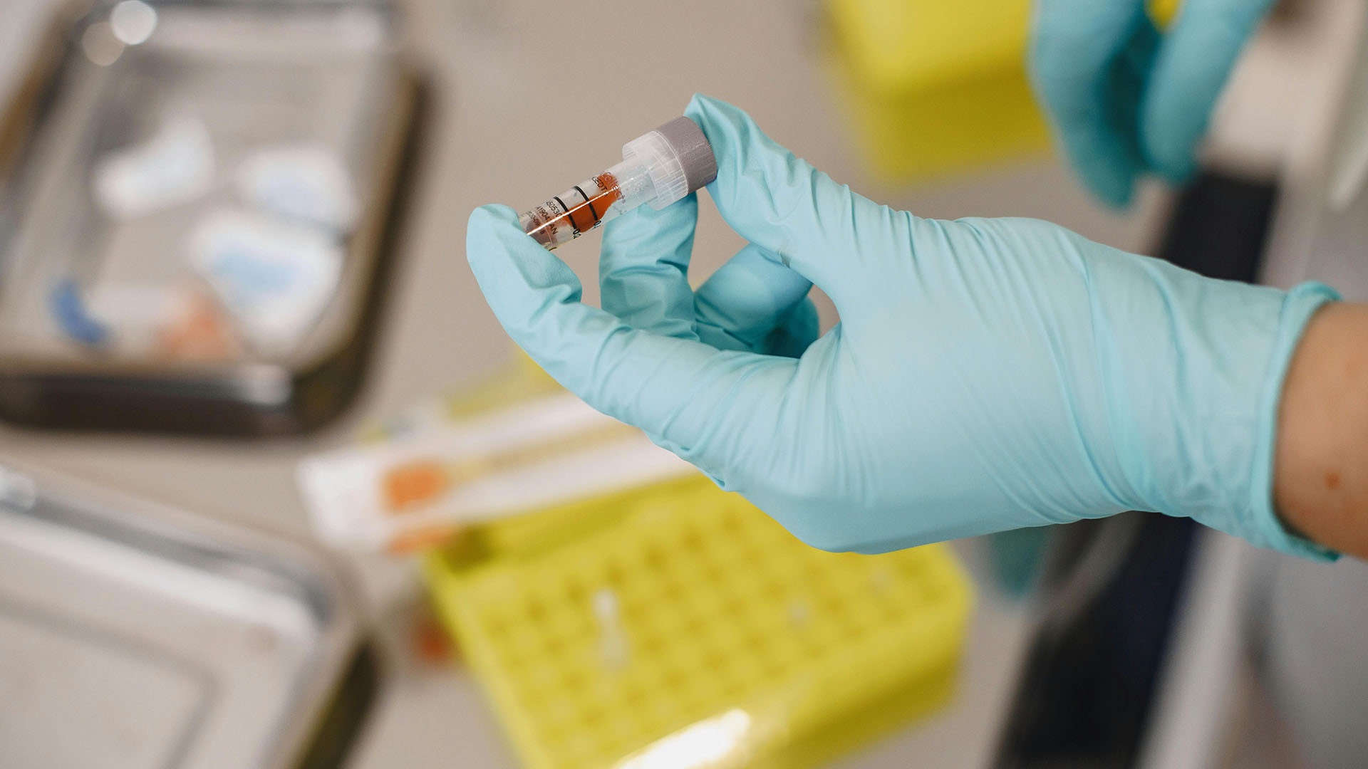 Application PRP (Plasma Riche en Plaquettes) — Pr. ass. Hüray Hügül