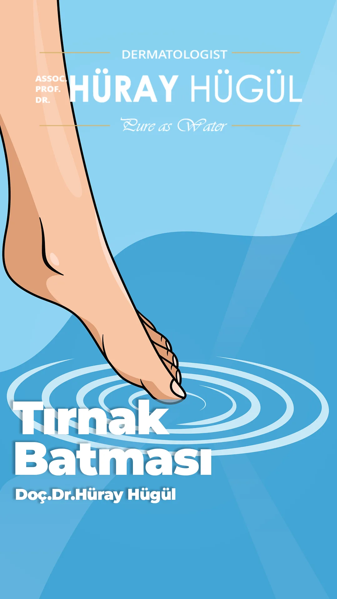 Tırnak Batması