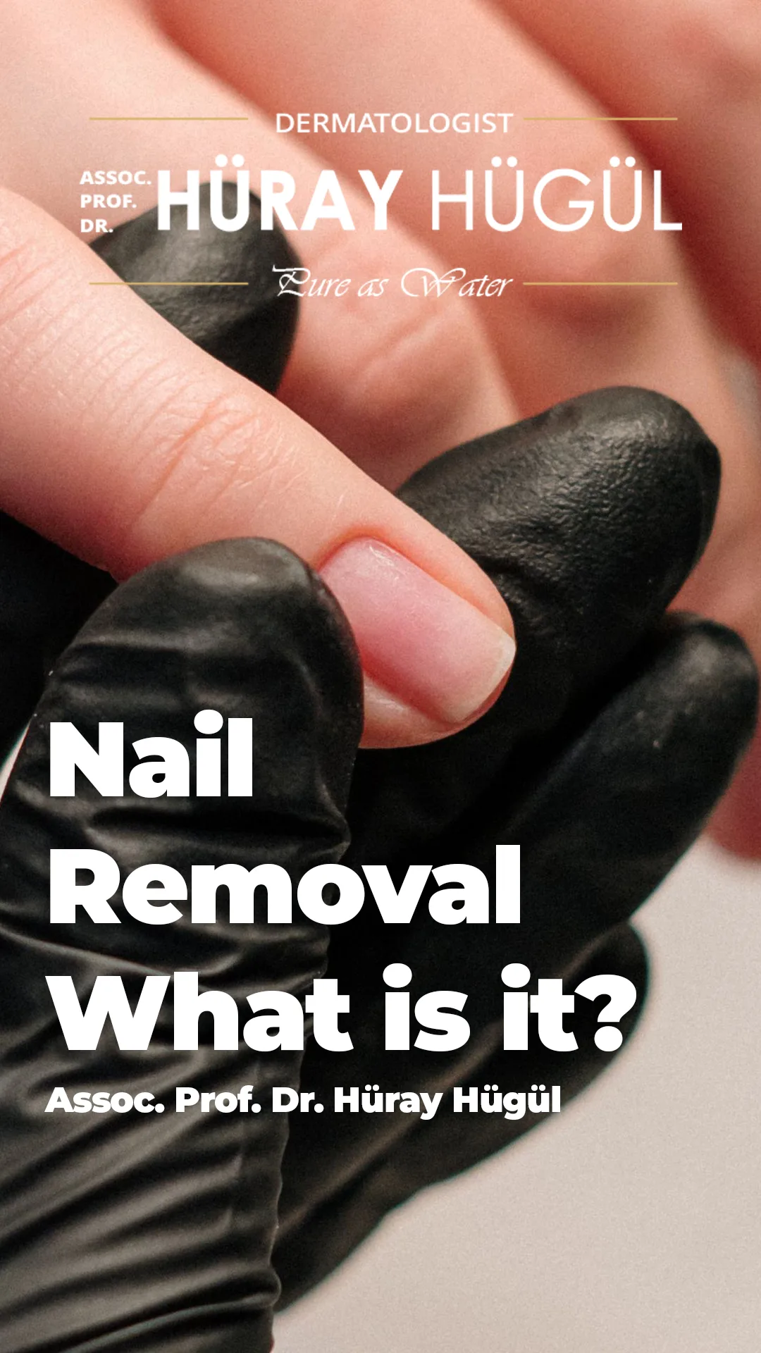 Nail Extraction