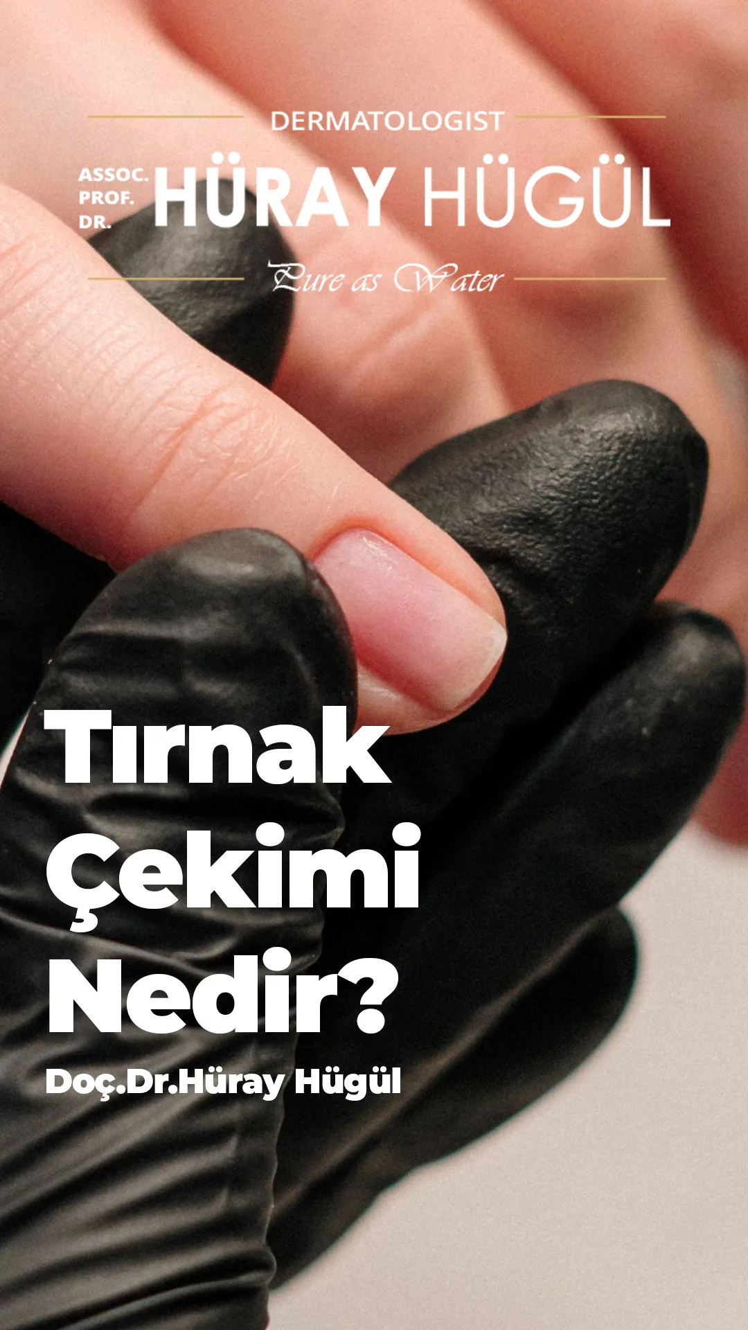 Tırnak Çekimi
